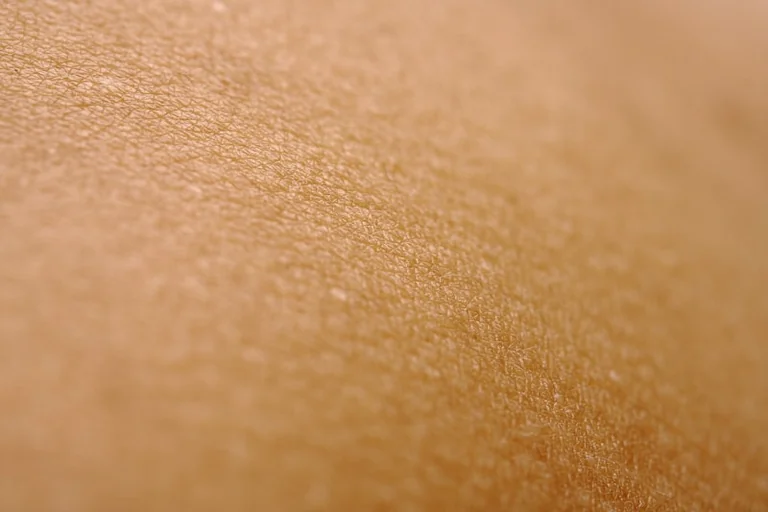 Erkių rizika Lietuvoje pasiekia piką: kada kreiptis pagalbos